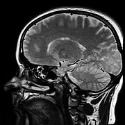 Figure 1. The human brain. (Source: pixabay)